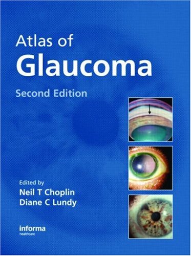 Atlas of Glaucoma, Second Edition,New