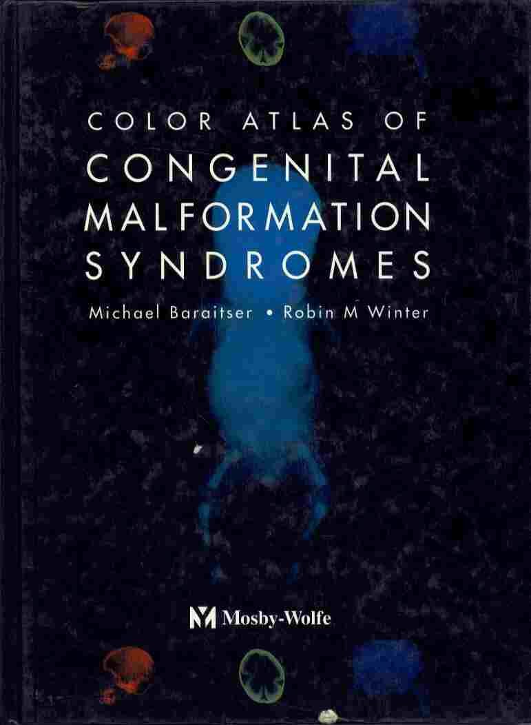 Color Atlas of Congenital Malformation Syndromes,Used