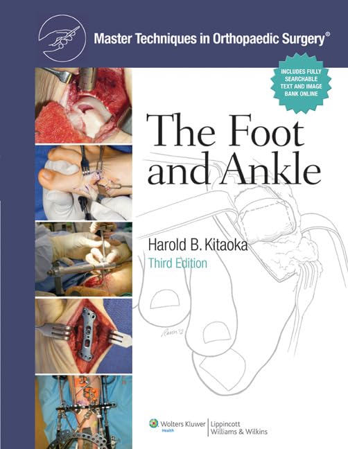 Master Techniques In Orthopaedic Surgery: The Foot And Ankle