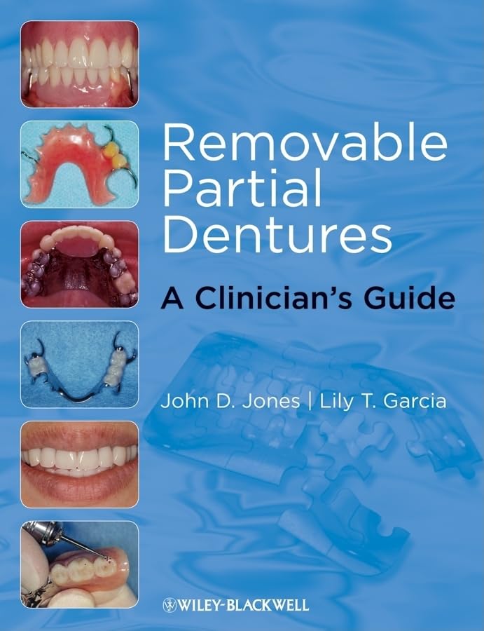 Removable Partial Dentures: A Clinician's Guide,New