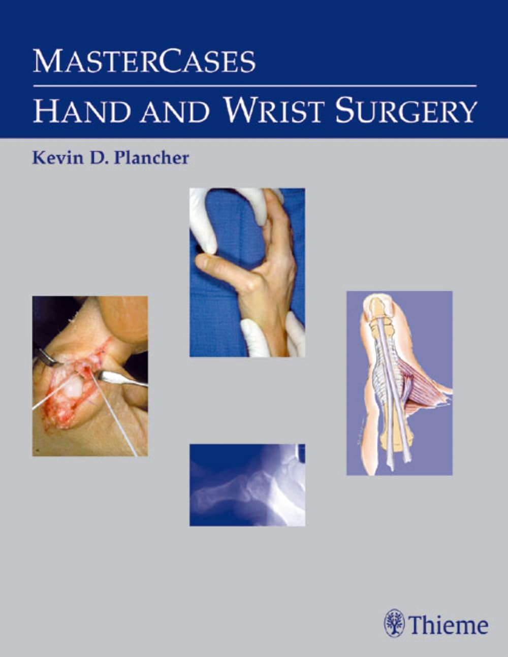 Mastercases In Hand And Wrist Surgery,Used