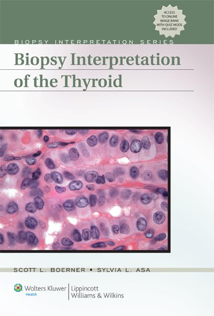 Biopsy Interpretation of the Thyroid (Biopsy Interpretation Series),Used