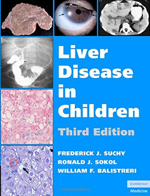 Liver Disease in Children,Used