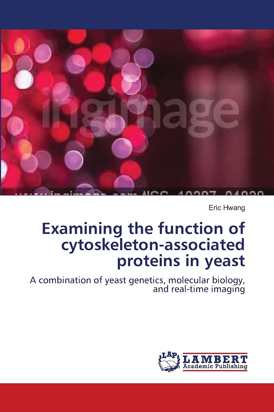 Examining the function of cytoskeletonassociated proteins in yeast: A combination of yeast genetics, molecular biology, and rea,Used