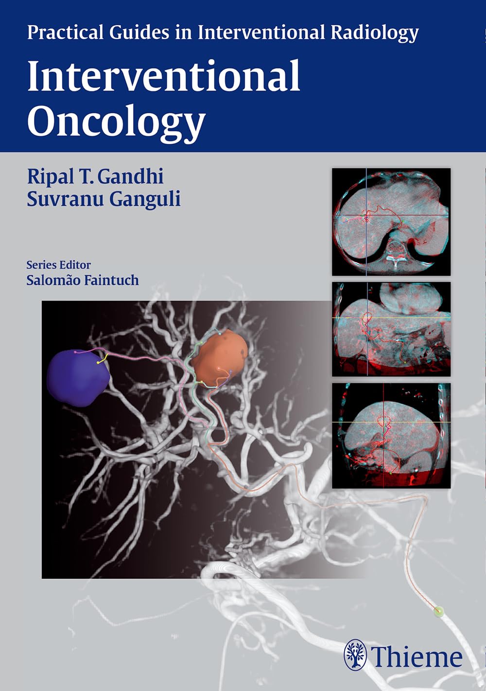 Interventional Oncology (Practical Guides in Interventional Radiology),Used