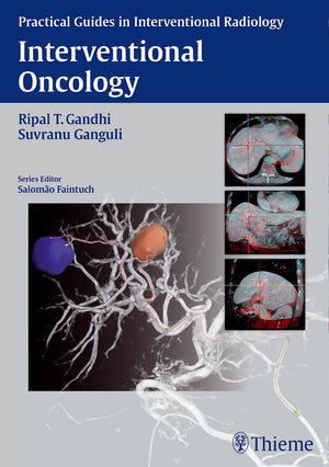 Interventional Oncology (Practical Guides in Interventional Radiology),Used
