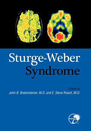 SturgeWeber Syndrome,Used