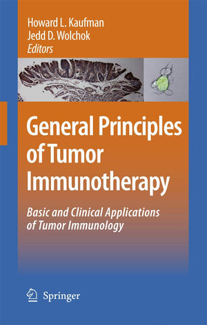 General Principles of Tumor Immunotherapy: Basic and Clinical Applications of Tumor Immunology,Used