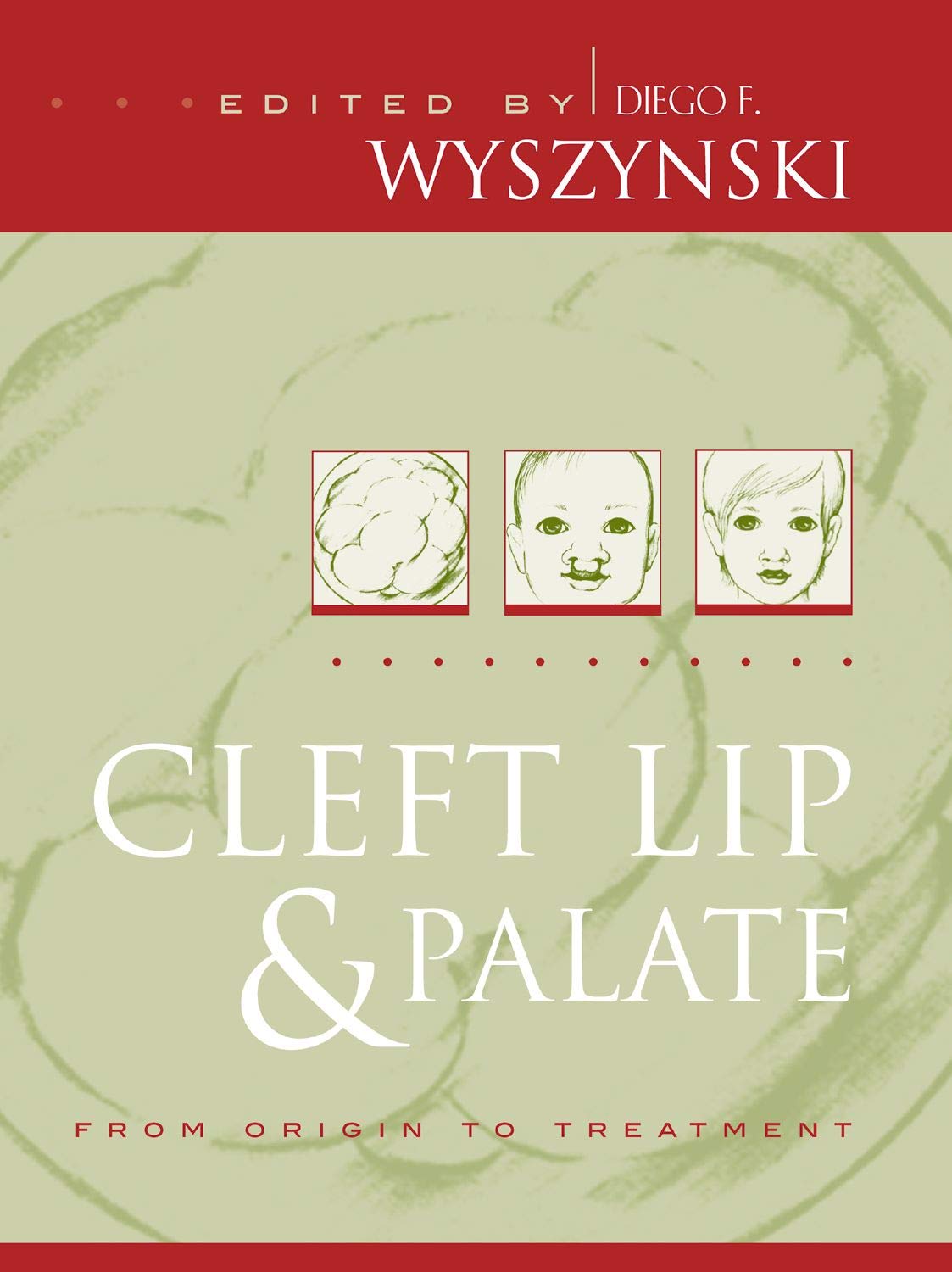 Cleft Lip And Palate: From Origin To Treatment,Used