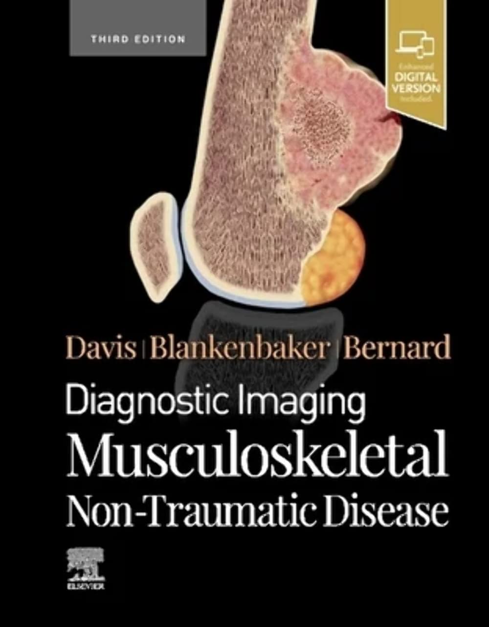 Diagnostic Imaging: Musculoskeletal NonTraumatic Disease