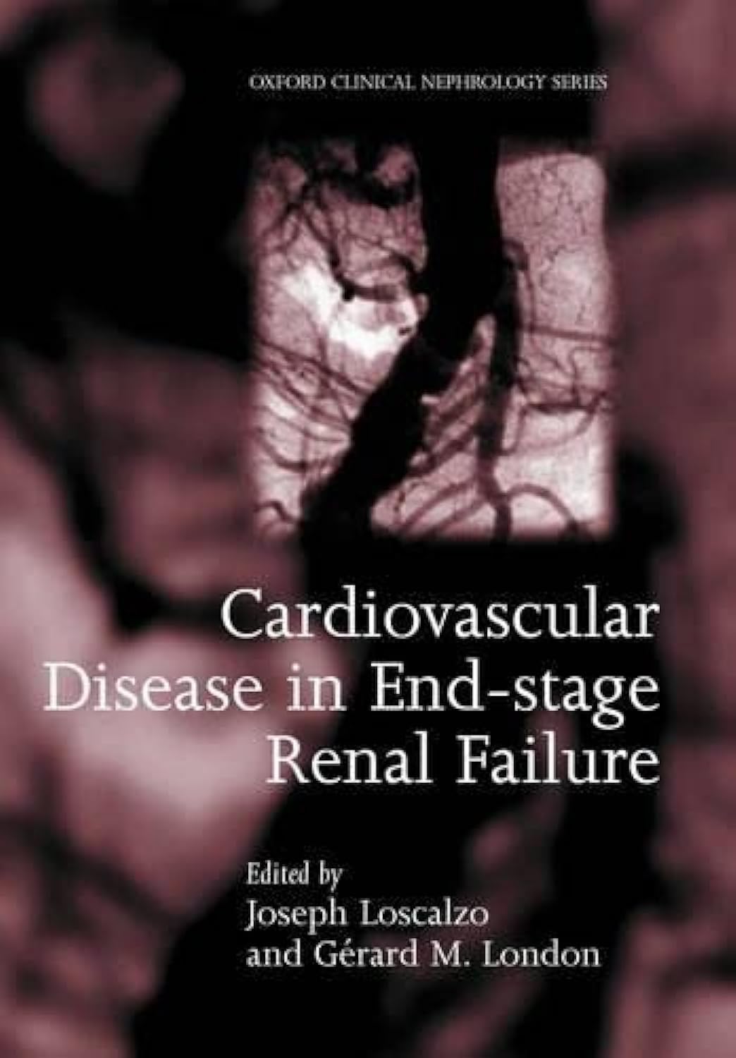 Cardiovascular Disease in EndStage Renal Failure,Used