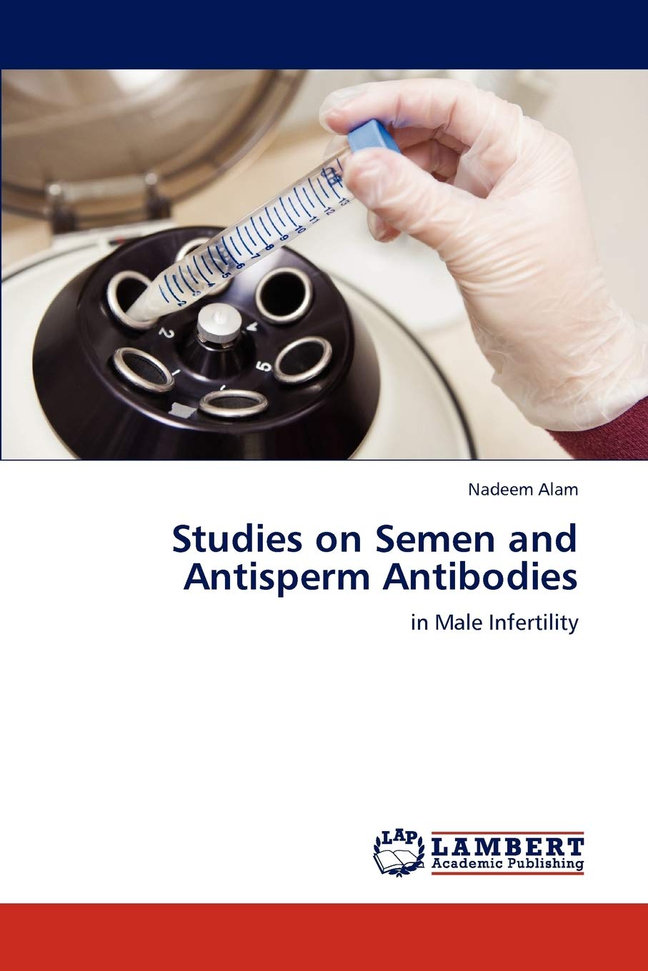 Studies on Semen and Antisperm Antibodies: in Male Infertility,Used
