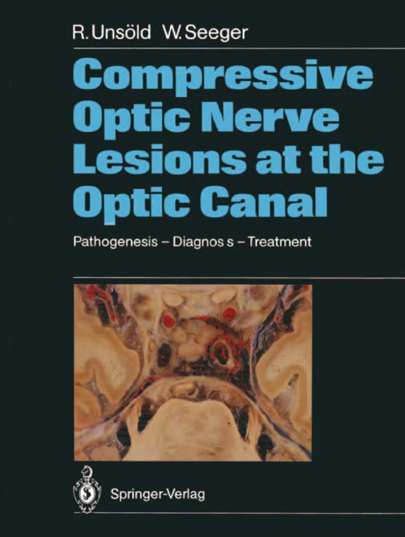 Compressive Optic Nerve Lesions At The Optic Canal: Pathogenesis  Diagnosis  Treatment,New