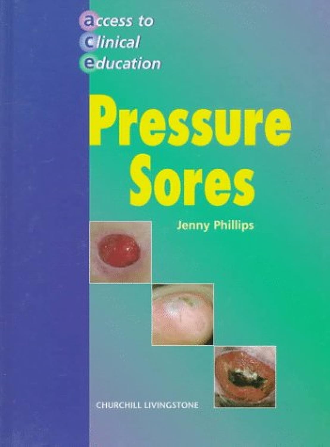 Pressure Ulcers (Access to Clinical Education),Used