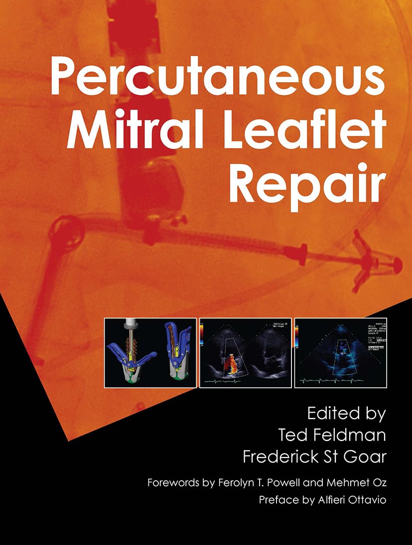 Percutaneous Mitral Leaflet Repair: MitraClip Therapy for Mitral Regurgitation,Used