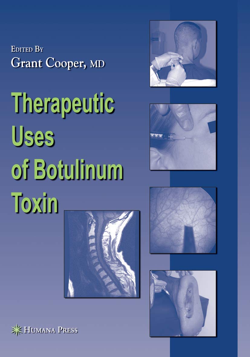 Therapeutic Uses of Botulinum Toxin (Musculoskeletal Medicine),New