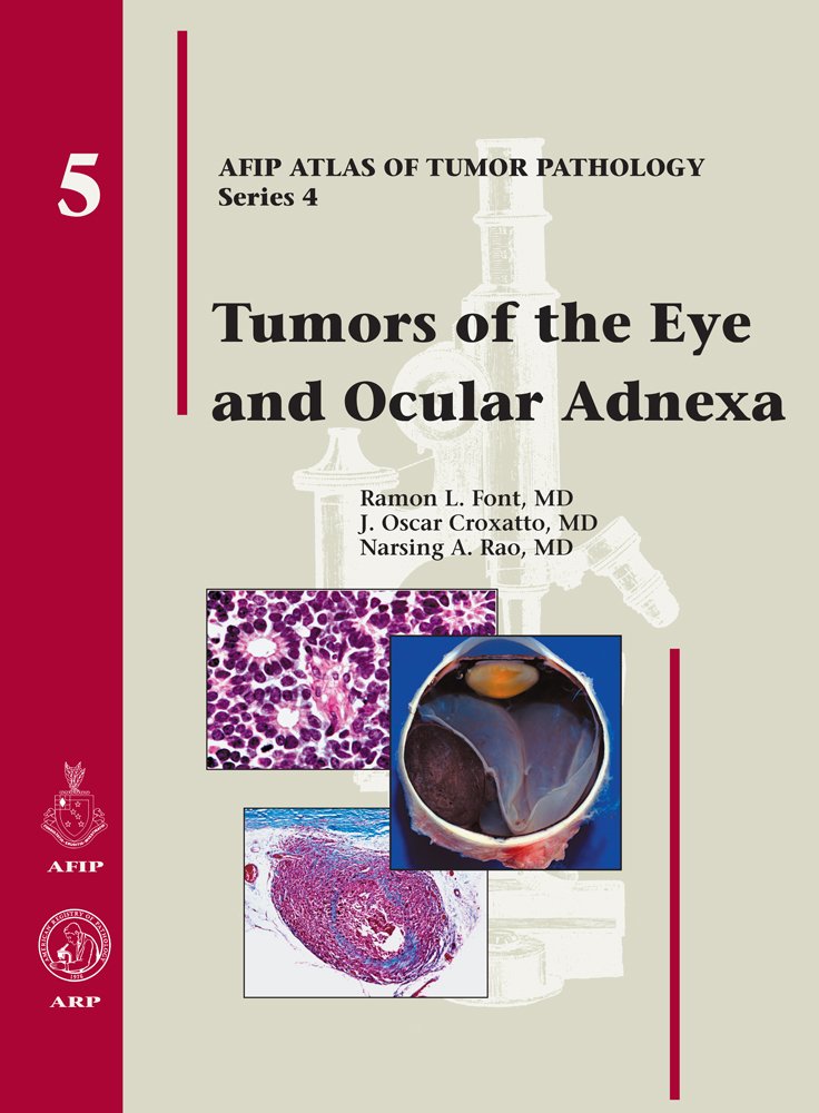 Tumors Of The Eye And Ocular Adnexa (Afip Atlas Of Tumor Pathology)