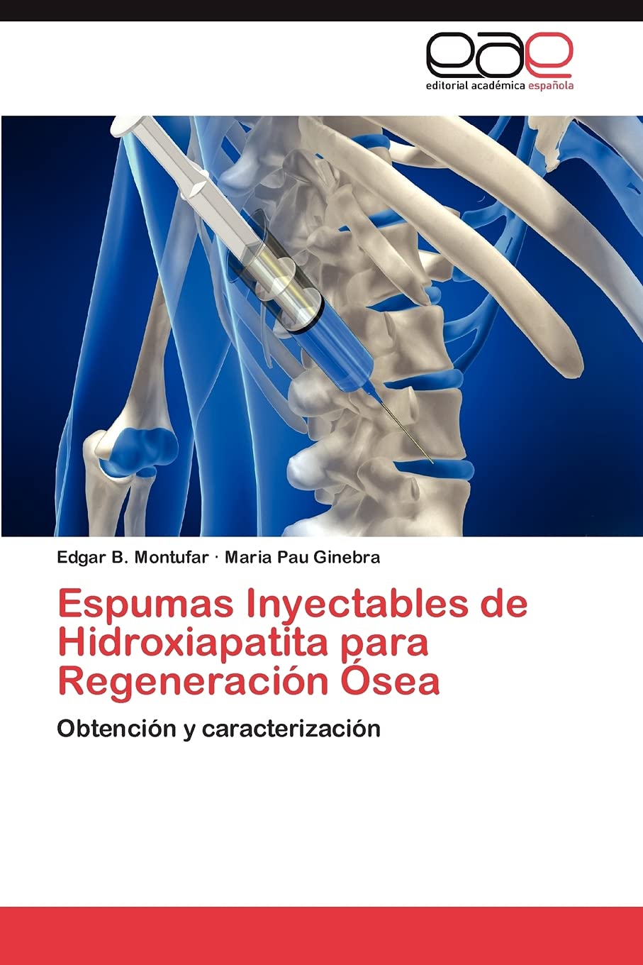 Espumas Inyectables de Hidroxiapatita para Regeneracin sea: Obtencin y caracterizacin (Spanish Edition),Used