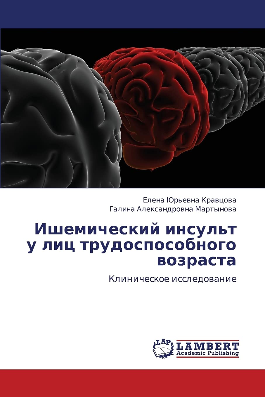 Ishemicheskiy insul't u lits trudosposobnogo vozrasta: Klinicheskoe issledovanie (Russian Edition),Used