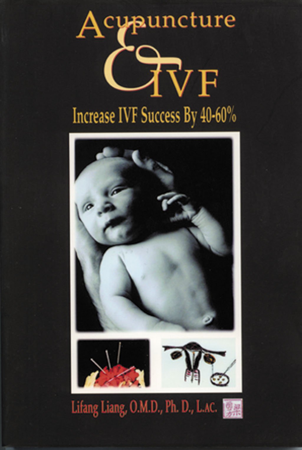 Acupuncture & IVF: Increase IVF Success by 4060%,Used