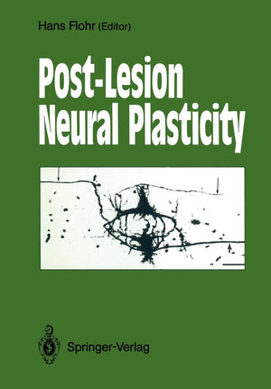 PostLesion Neural Plasticity,Used