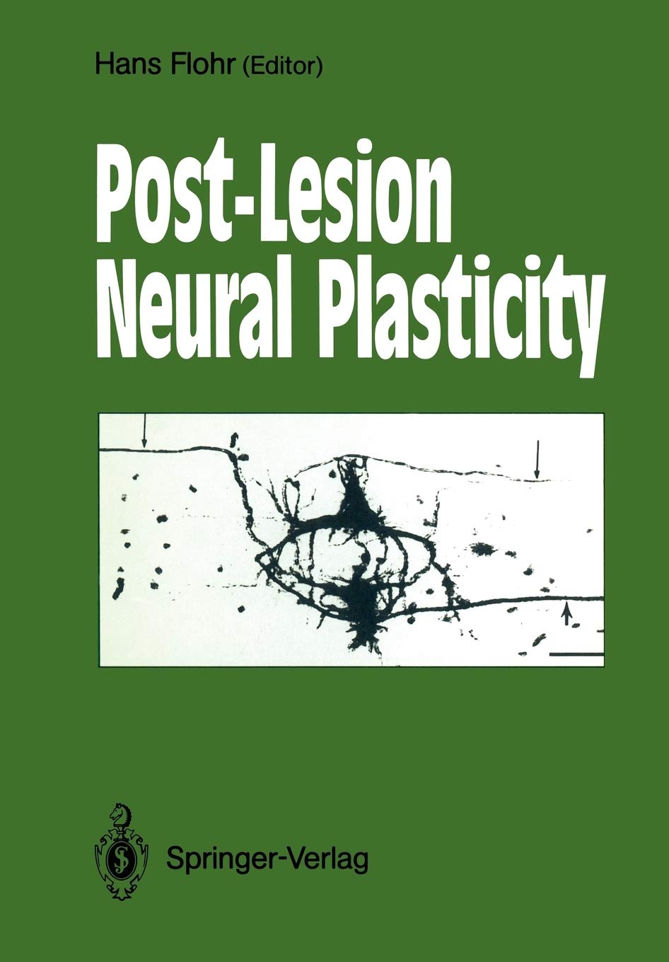 PostLesion Neural Plasticity,Used