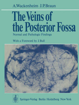 The Veins of the Posterior Fossa: Normal and Pathologic Findings,Used