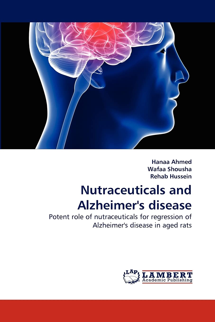 Nutraceuticals and Alzheimer's disease: Potent role of nutraceuticals for regression of Alzheimer's disease in aged rats,Used