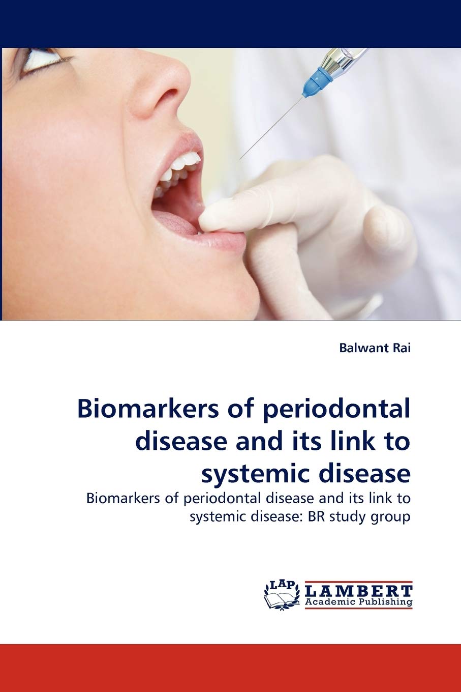 Biomarkers of periodontal disease and its link to systemic disease: Biomarkers of periodontal disease and its link to systemic d,Used