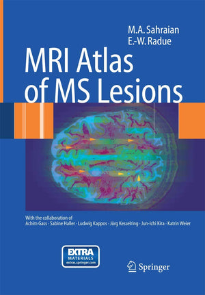 MRI Atlas of MS Lesions,Used