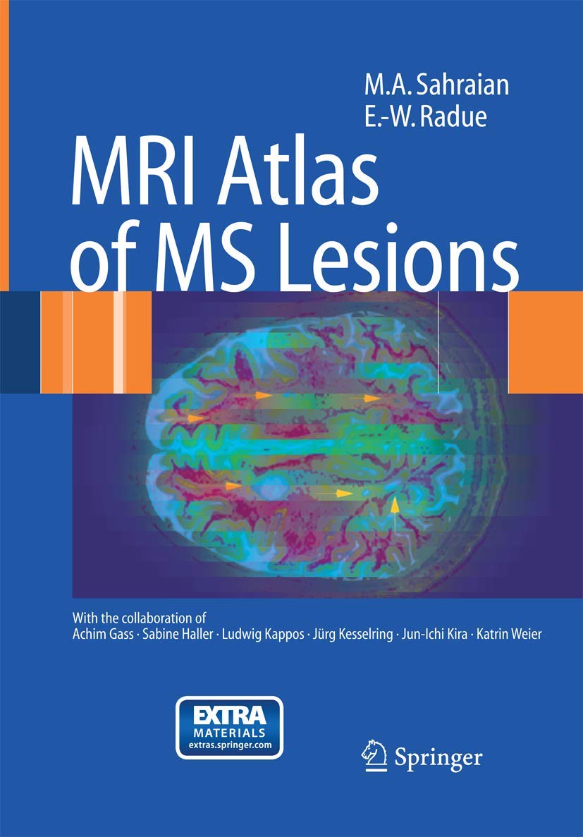 MRI Atlas of MS Lesions,Used