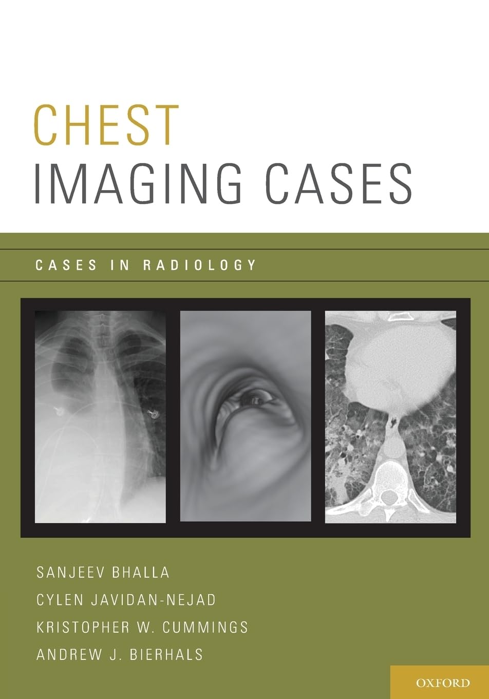 Chest Imaging Cases (Cases in Radiology),Used