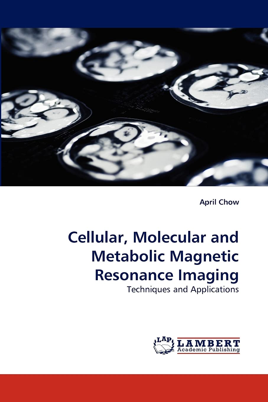 Cellular, Molecular and Metabolic Magnetic Resonance Imaging: Techniques and Applications,Used
