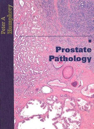 Prostate Pathology,Used