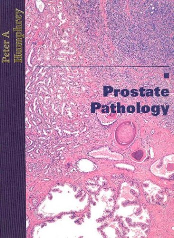 Prostate Pathology,Used