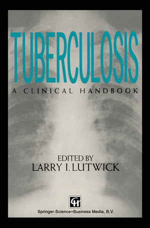 Tuberculosis,Used