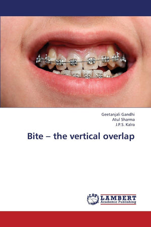 Bite  the vertical overlap,Used