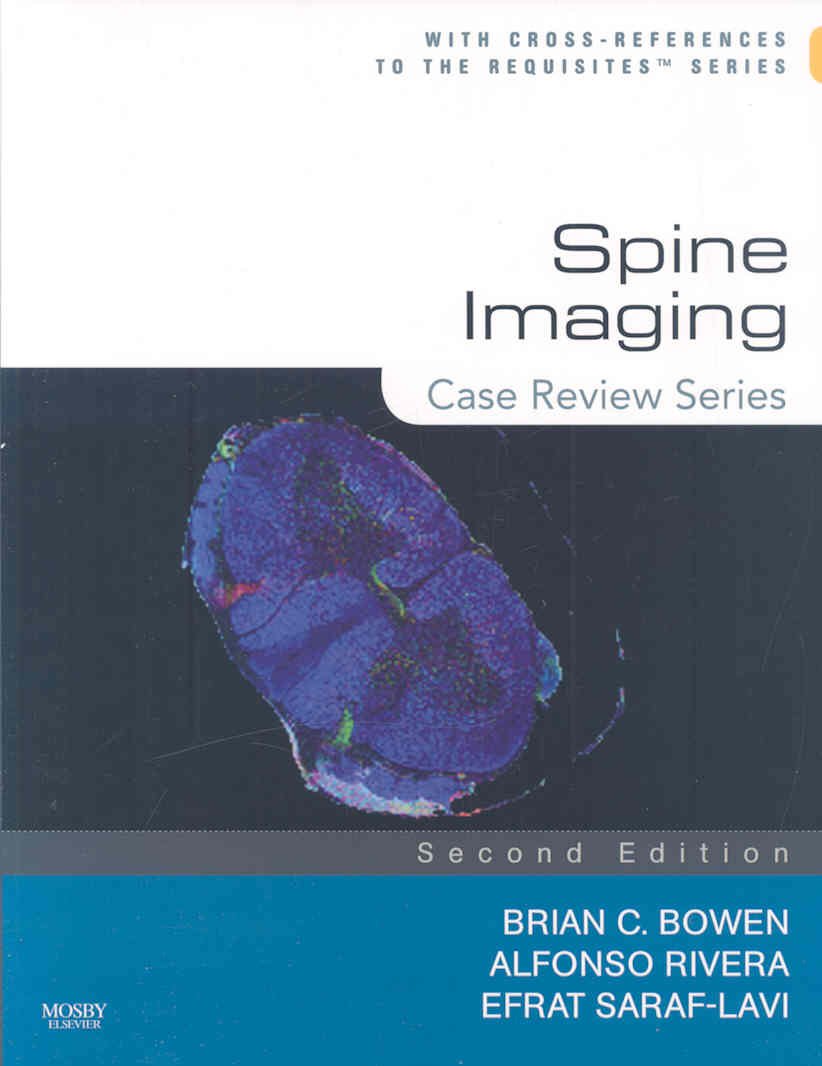 Spine Imaging: Case Review Series,Used