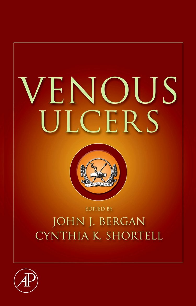 Venous Ulcers,Used