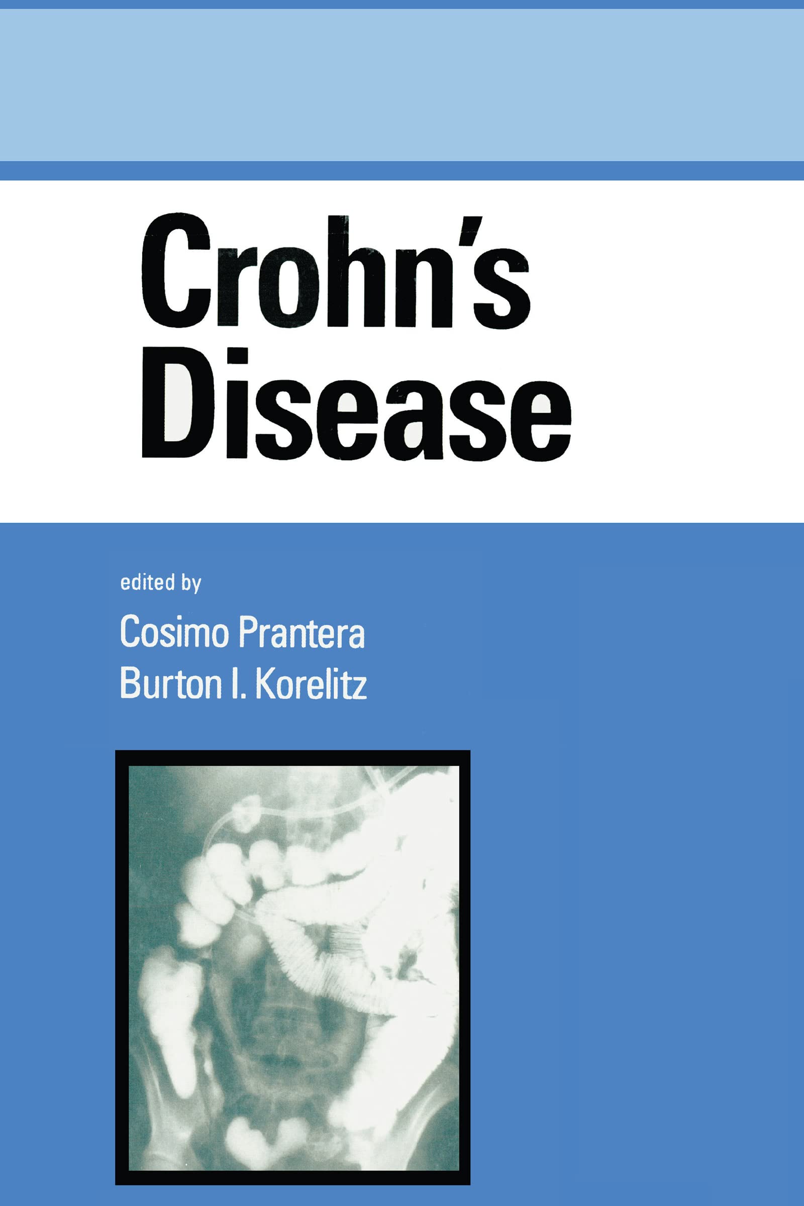 Crohn'S Disease (Gastroenterology And Hepatology),Used