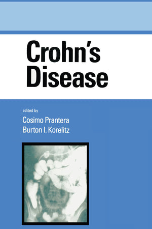 Crohn'S Disease (Gastroenterology And Hepatology),Used