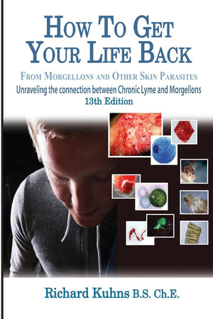 How To Get Your Life Back From Morgellons And Other Skin Parasites Limited Edit