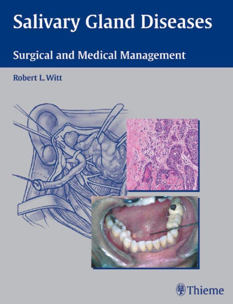 Salivary Gland Diseases: Surgical and Medical Management,Used