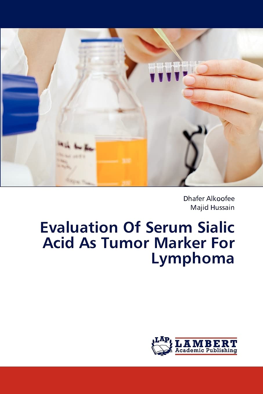 Evaluation Of Serum Sialic Acid As Tumor Marker For Lymphoma,Used