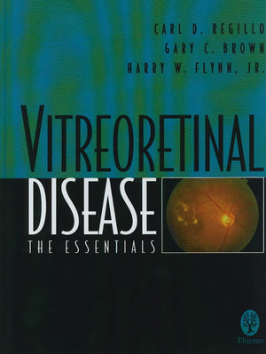 Vitreoretinal Disease: The Essentials,Used