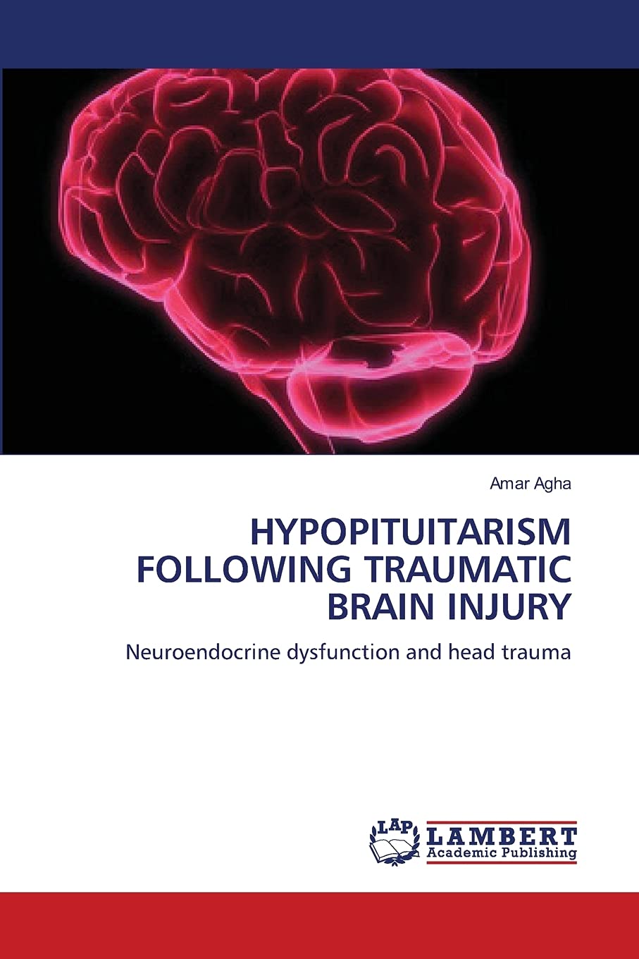 HYPOPITUITARISM FOLLOWING TRAUMATIC BRAIN INJURY: Neuroendocrine dysfunction and head trauma,Used
