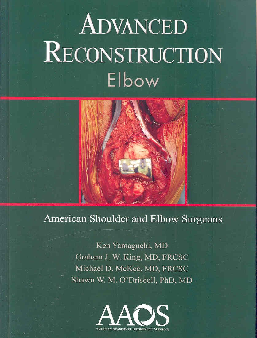 Advanced Reconstruction Elbow,Used