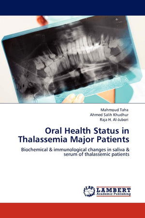 Oral Health Status in Thalassemia Major Patients: Biochemical & immunological changes in saliva & serum of thalassemic patients,Used