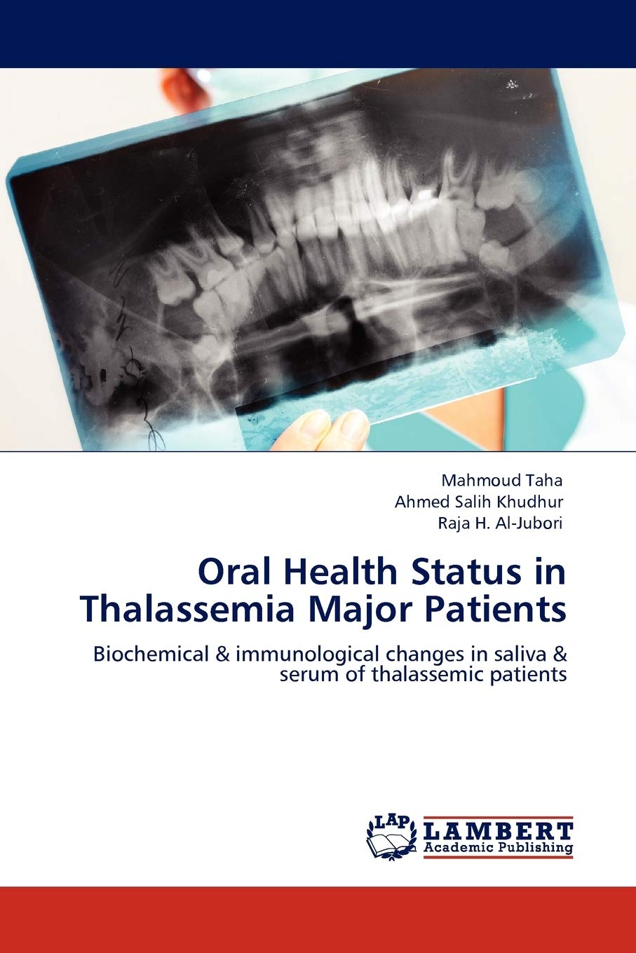 Oral Health Status in Thalassemia Major Patients: Biochemical & immunological changes in saliva & serum of thalassemic patients,Used