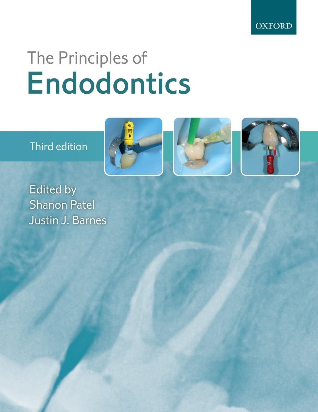 The Principles of Endodontics,Used